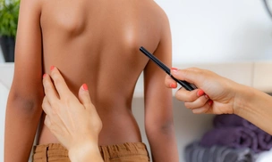 От корсета до любви к себе: врачи рассказали, как жить со сколиозом, чтобы не было мучительно больно