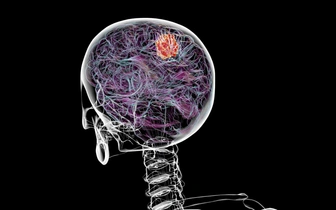 Подобраться изнутри: как в России ищут способ победить глиобластому — самый агрессивный вид рака мозга
