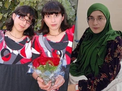 Онкология и проблемы с почками: одна из сиамских близнецов Гита попала в больницу