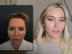 Блогерша Катя Конасова показала шокирующие фото до и после пластики