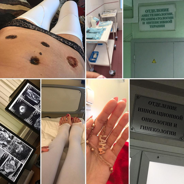 Лама Сафонова шокировала снимками после серьезной операции