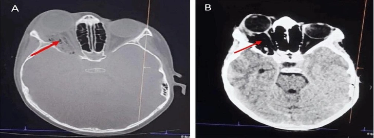 Источник: BMJ Case Reports