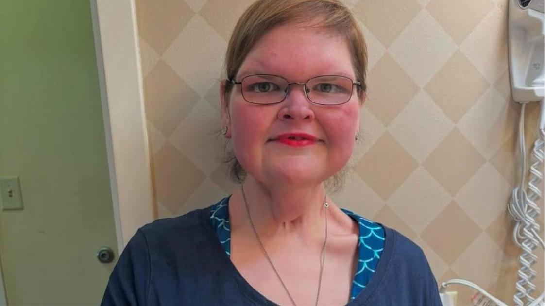 Ноги как столбы: Тэмми Слейтон сбросила 220 кг, но теперь борется с последствиями — фото