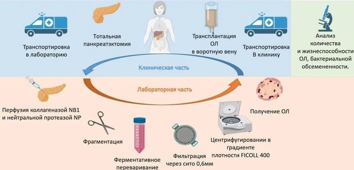 Впервые в России пациентам без поджелудочной пересадили в печень клетки, вырабатывающие инсулин