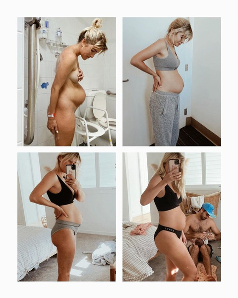«Мое тело никуда не уходило»: 8 честных (и прекрасных!) фотографий женщин после родов