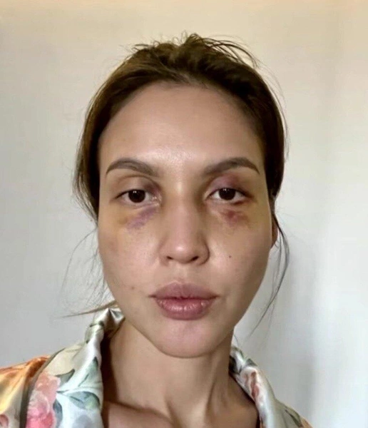 Салтанат сама прислала брату это фото, а ее ассистентка рассказывала, что летом видела на шее астролога следы от веревок