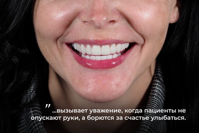 Визит в новосибирскую клинику Татьяна считает началом новой жизни | Источник: международный центр имплантологии iDENT