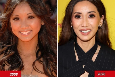 Бренда Сонг: хорошие гены или хорошие доктора?