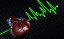 Cколько стоят инфаркты миокарда в России