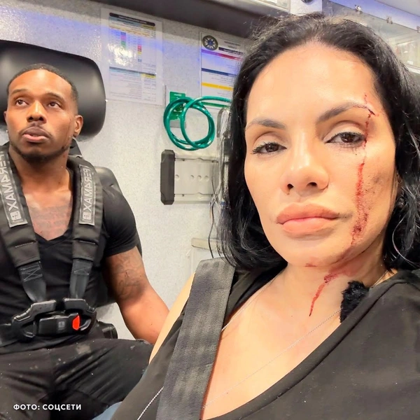 К счастью, блогеры не сильно пострадали | Источник: Shot / Telegram