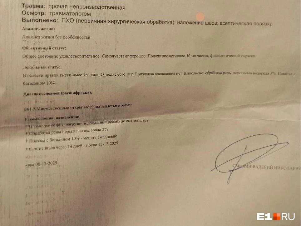 Девочка получила множественные открытые раны | Источник: читатель E1.RU