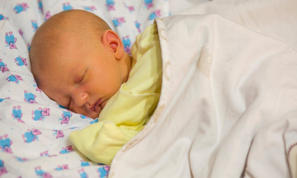 Желтушка у новорожденных дома. Двухмесячный ребенок. Желтушка у новорожденного фото. Желтушка у ребенка в 1 месяц. Новорожденные с желтушкой фото.