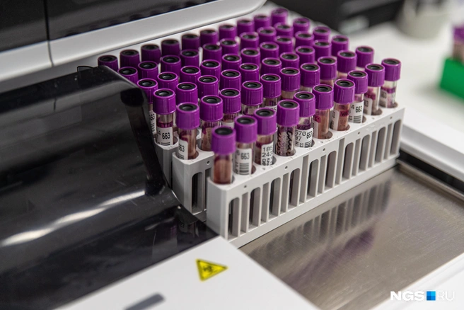 Нельзя допускать, как дефицита, так и избытка витамина D | Источник: Александр Ощепков / NGS.RU