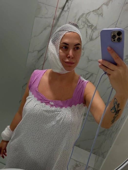 Недавно женщина уже перенесла операцию | Источник: friske_natalia / Instagram (экстремистская организация, деятельность запрещена на территории РФ)