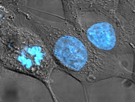 HeLa: как впервые удалось культивировать «бессмертные» клетки человеческого тела