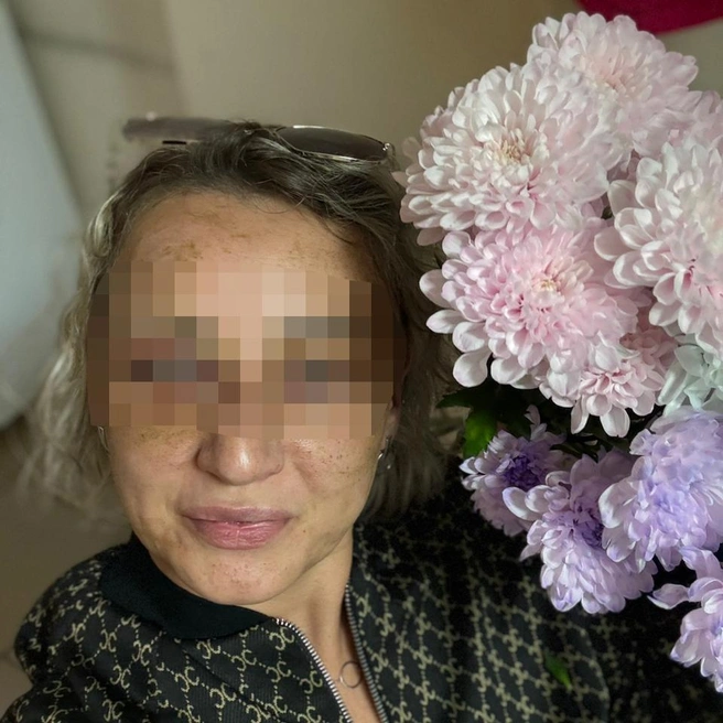 Евгения часто ходила с синяками по всему телу, но долго скрывала от близких, что происходит | Источник: предоставила Наталья Заболотная