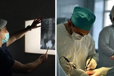 В Омске извлекли огромный камень из мочевого пузыря