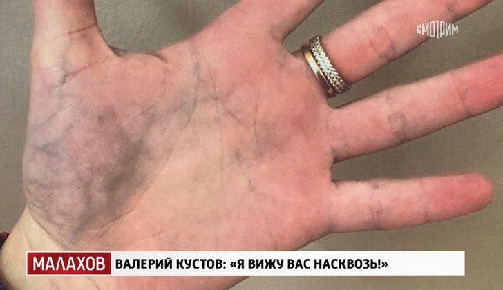Вылечил чернеющие руки и избавил от кровавых слез: невероятные способности целителя Валерия Кустова