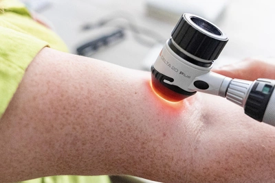 Частые опухоли у новосибирцев в 2025 году