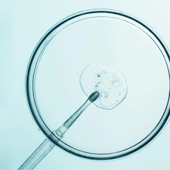 «Мне собираются удалять матку — можно ли одновременно с этим заморозить яйцеклетки?»