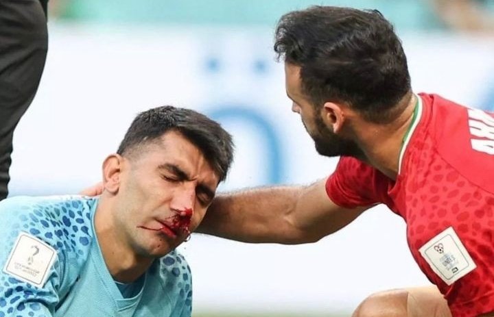 Первая травма ЧМ-2022: вратарь Ирана жутко влетел головой в своего: несколько минут лежал на газоне, истекая кровью