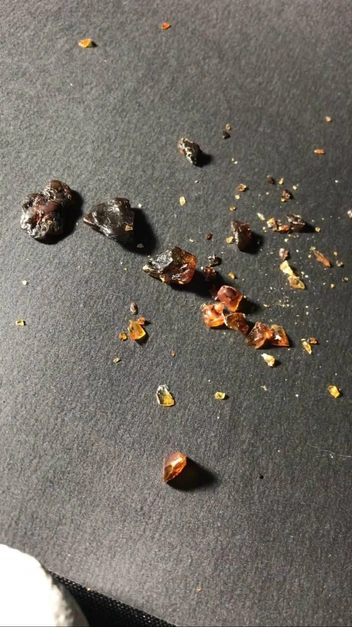 Получаются такие небольшие фракции | Источник: ТГ-канал Марины