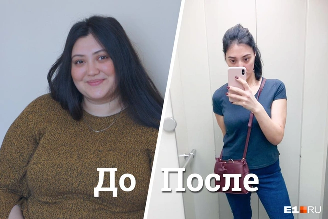 Вот так выглядит одна из пациенток, которой уже сделали операцию в больнице Екатеринбурга в 2017 году | Источник: пресс-служба 40-й больницы
