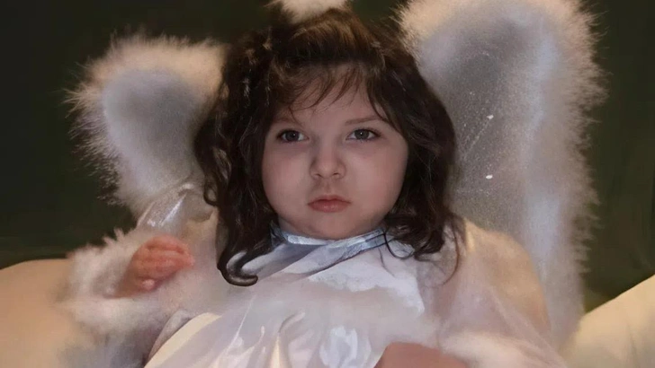 Ей удалось дожить до 20 лет: как сейчас живет девочка, которая появилась на свет без мозг, Шон Симпсон, Лорен Симпсон, Алекс Симпсон | Источник: Daily Mail