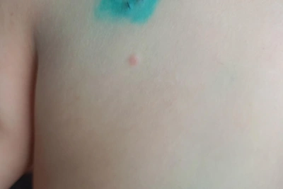 Подросток из Верхней Пышмы получит полмиллиона за нападение