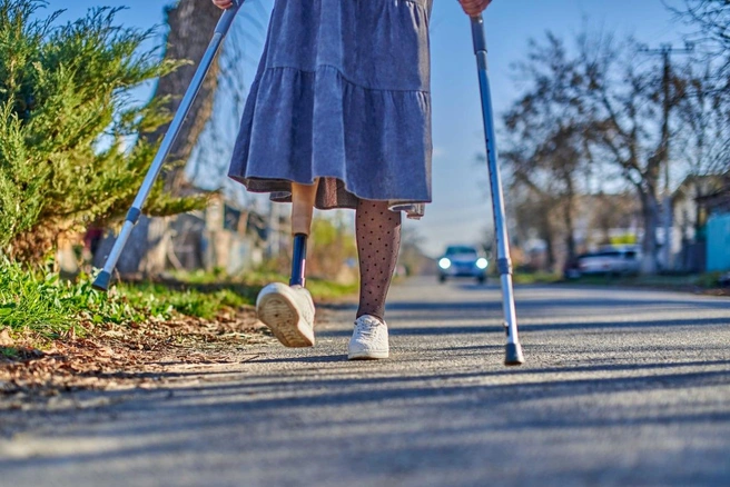 Светлана долго решалась на ампутацию после аварии | Источник: «Ортодэй»