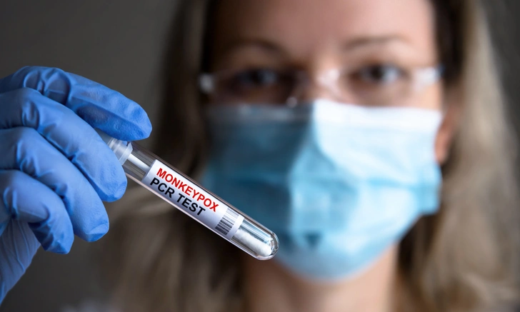 В Петербурге двое попали в больницу с оспой обезьян: всего в России уже пять случаев | doctorpiter.ru