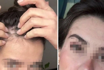 Хирург обвинен в домогательствах после неудачной пластики