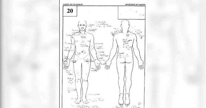 Вскрытие показало, что у певца было множество травм | Источник: COUNTY OF LOS ANGELES CORONER