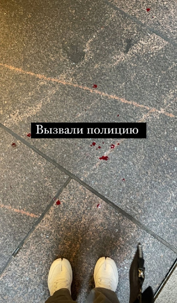 Охранник Эрмитажа избил бойфренда блогера Насти Мироновой