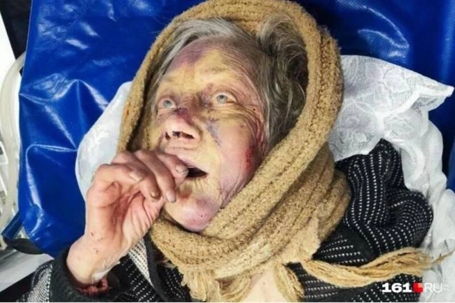 В таком виде Нину Прокофьевну забрала скорая | Источник: предоставлено волонтерами