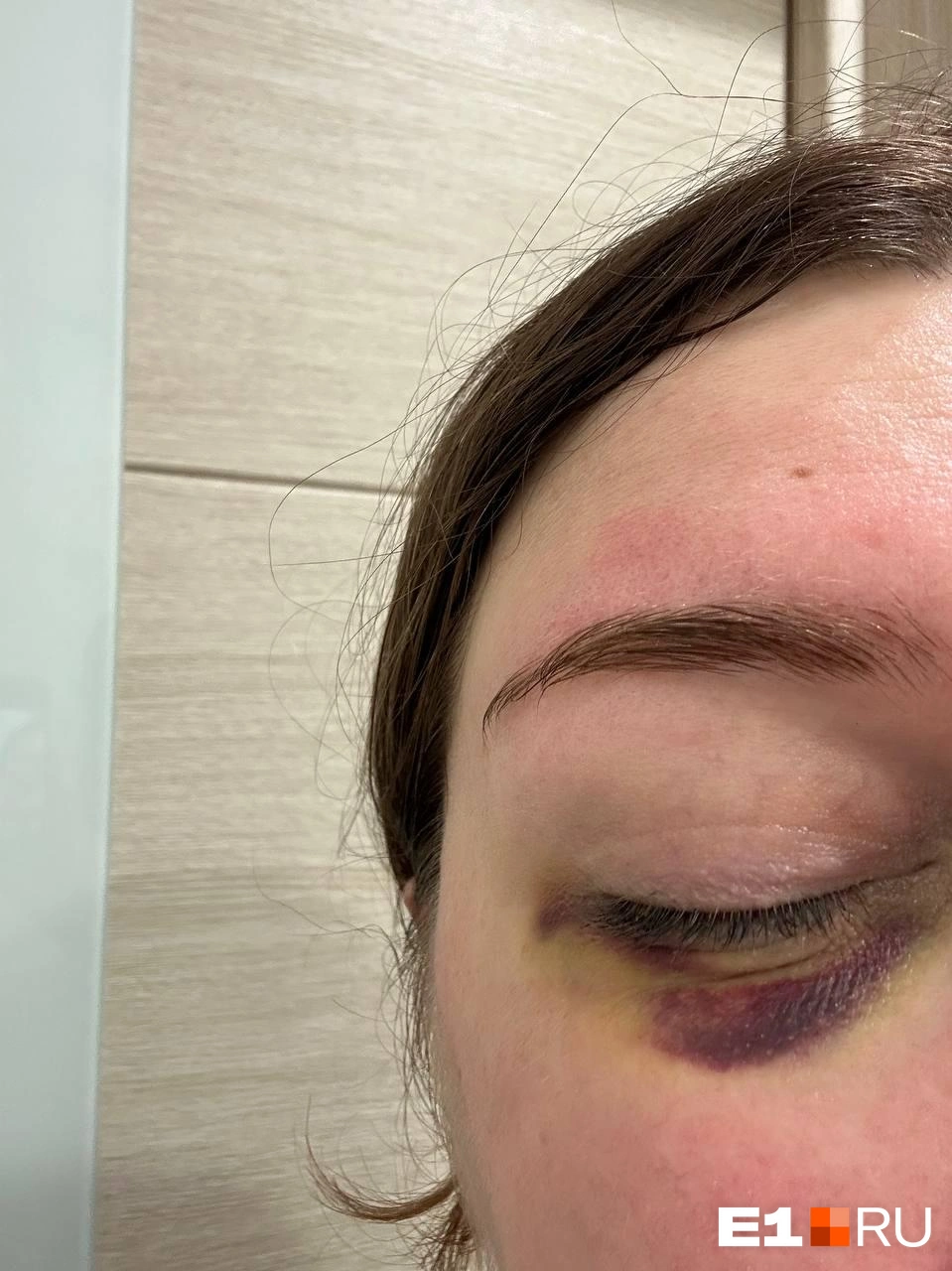 Последствия потасовки | Источник: читатель Е1.RU