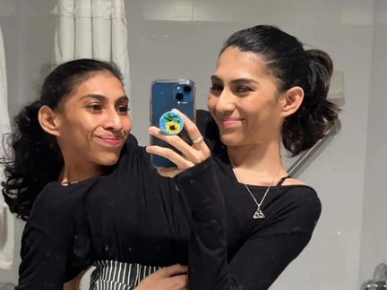 Сестры Кривошляповы спились после жестоких экспериментов, Зита покинула Гиту в 24. Судьбы сиамских близнецов