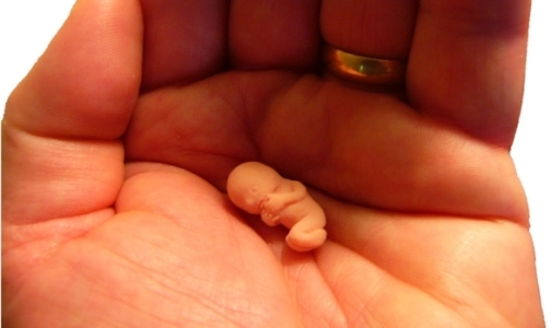 Фото №1 - В Петербурге судебные приставы защитили замороженных эмбрионов