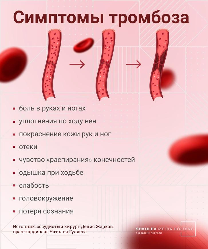 Симптомы тромбоза могут быть неспецифичными, свойственными многим заболеваниям | Источник: Виталий Калистратов / Городские порталы