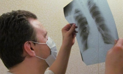 Депутаты попытаются сделать лечение туберкулеза принудительным