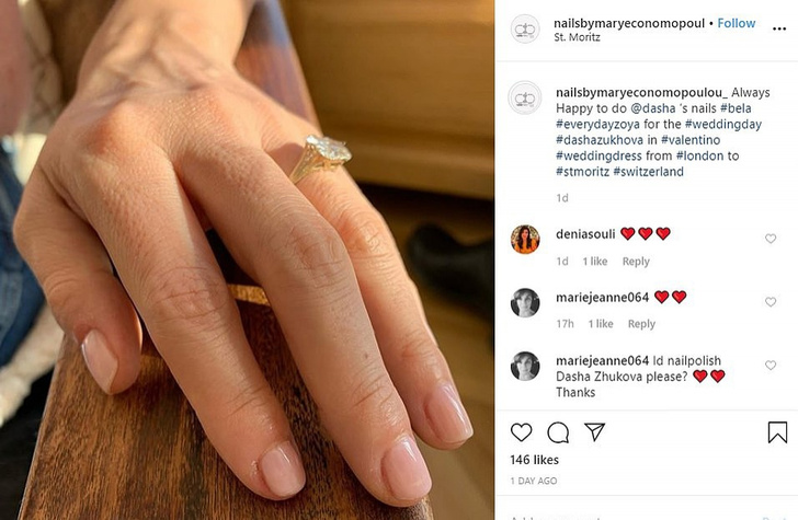 Руки не для скуки: Даша Жукова выходила замуж с обкусанными пальцами