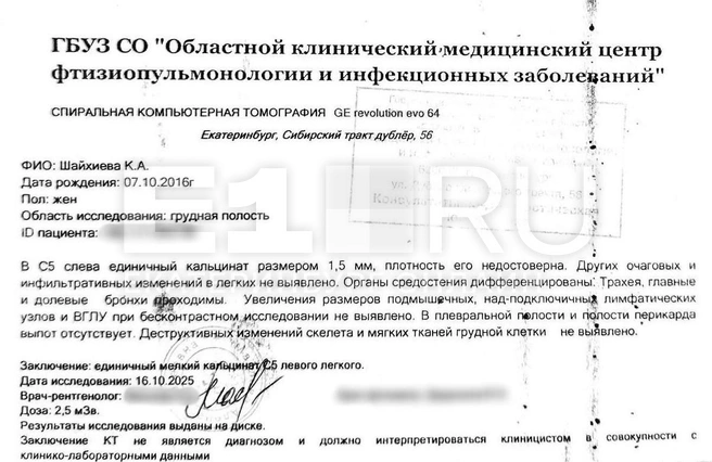 На одном из первых КТ у девочки обнаружили единичный кальцинат&nbsp;— участок отложения солей кальция в легких, указывающий на то, что в этом месте был воспалительный процесс, но больше ничего | Источник: Айрат Шайхиев