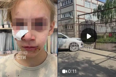 Девочку укусила собака во дворе школы Краснодара