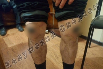 В Калуге расследовали дело об экстремистских татуировках