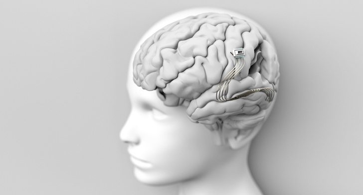 Шарики за ролики: Илон Маск хочет испытать мозговый имплант на живых людях