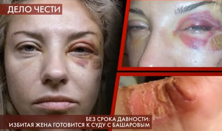 Первая жена Марата Башарова требует извинений от Екатерины Архаровой