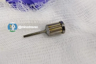 В Екатеринбурге врачи достали отвертку из живота пациентки