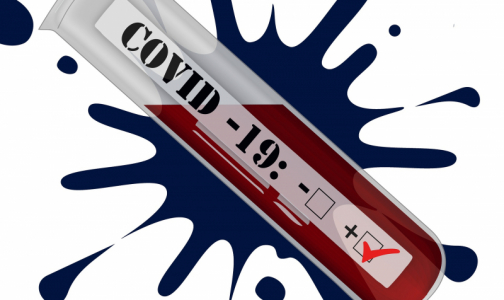 Минздрав собирается отменить требование о предъявлении результатов теста на COVID-19 при госпитализации