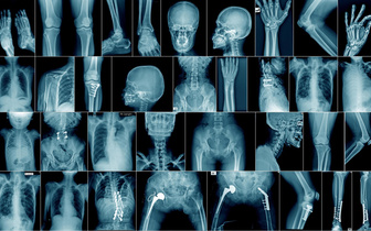 Подобное не подобным: 10 проблем, с которыми современная медицина справляется играючи