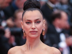 Ирина Шейк избавилась от «уставшего» взгляда с помощью пластики — фото до и после